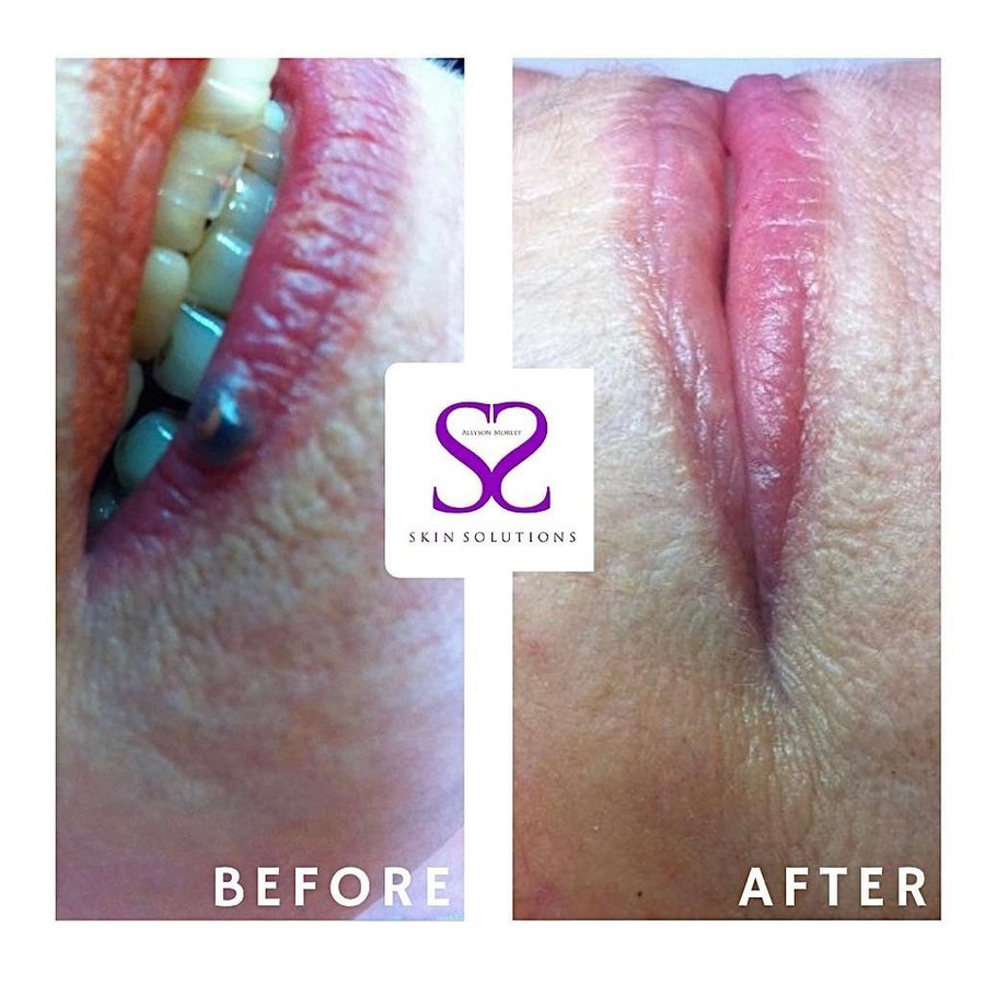 Skin Solutions - Skin Solutions