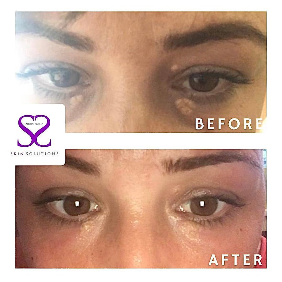 Skin Solutions - Skin Solutions