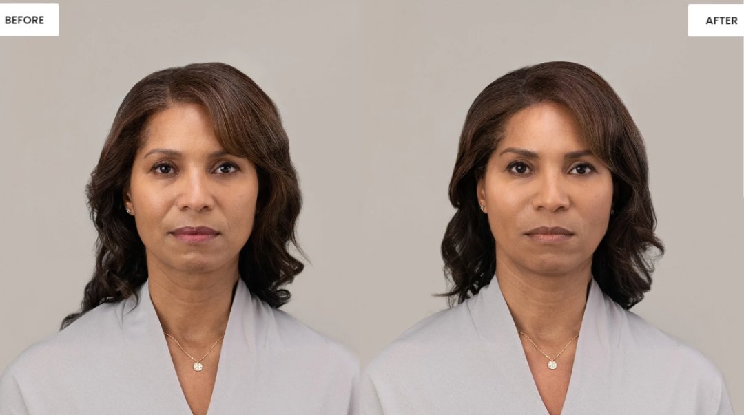 Skin Vitality Medical Clinic - Hamilton - Skin Vitality Medical Clinic - Hamilton