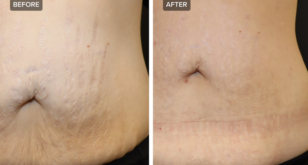 Skin Vitality Medical Clinic - Hamilton - Skin Vitality Medical Clinic - Hamilton