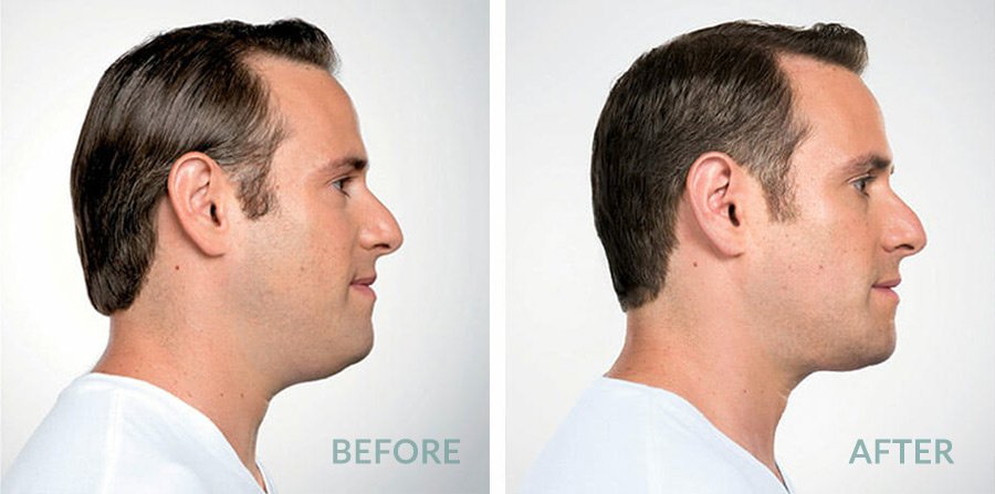 Skin Vitality Medical Clinic - Hamilton - Skin Vitality Medical Clinic - Hamilton