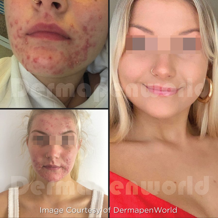 Skin Vitality Medical Clinic - Hamilton - Skin Vitality Medical Clinic - Hamilton