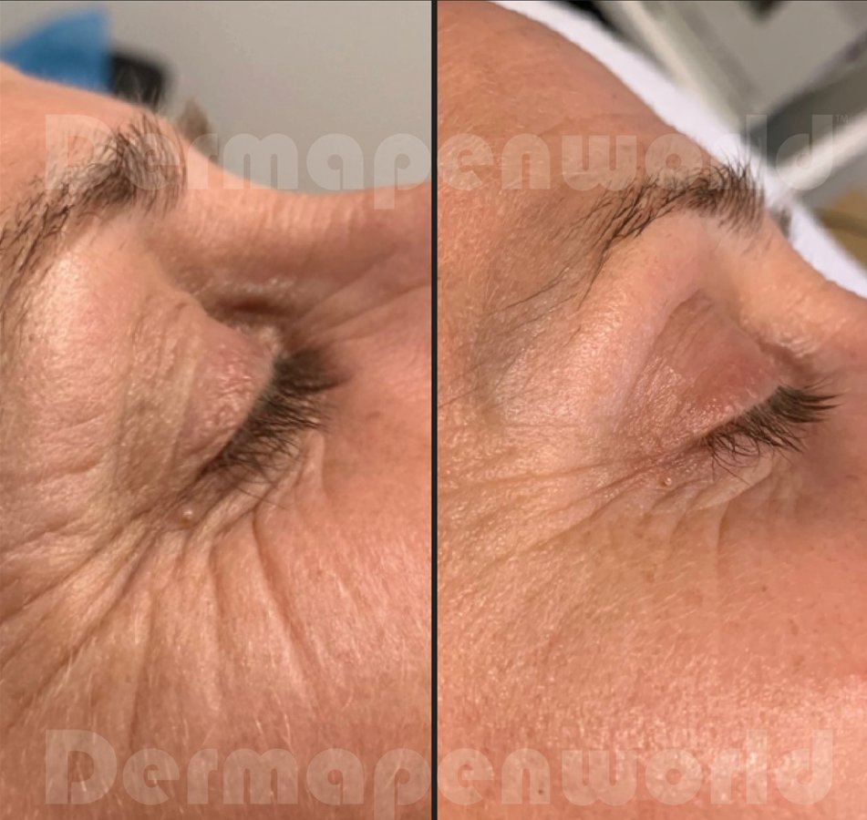 Skin Vitality Medical Clinic - Hamilton - Skin Vitality Medical Clinic - Hamilton