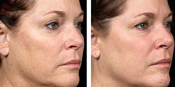 Skin Vitality Medical Clinic - Kitchener - Skin Vitality Medical Clinic - Kitchener
