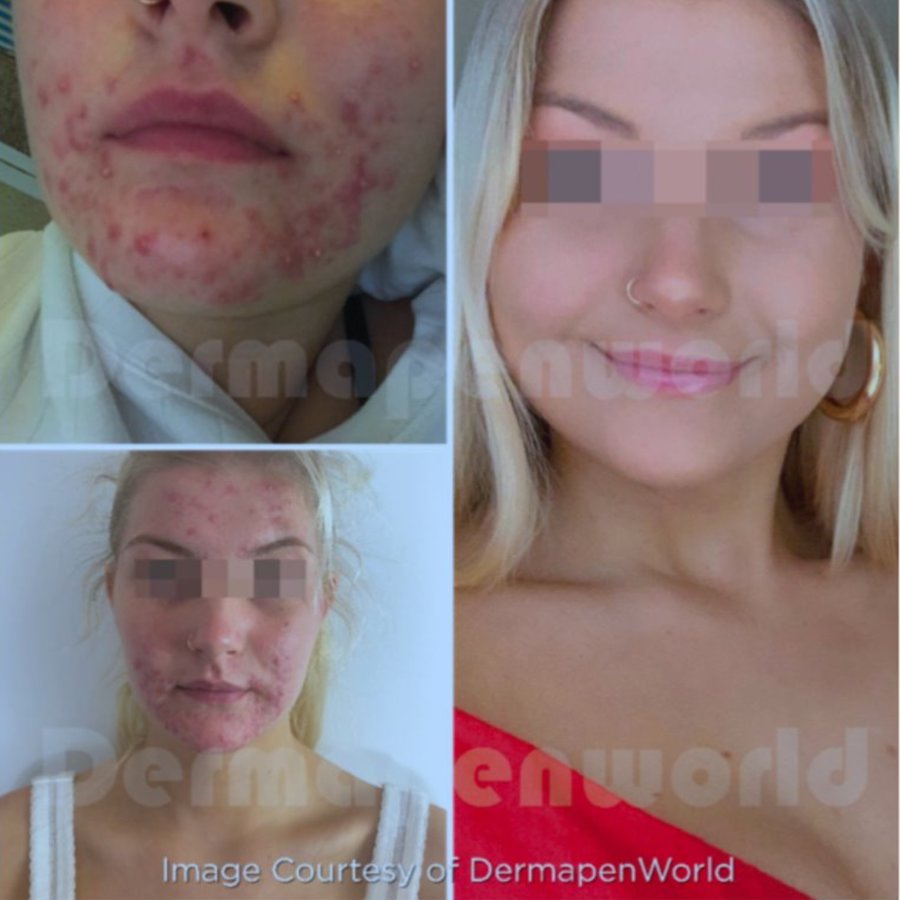 Skin Vitality Medical Clinic - London - Skin Vitality Medical Clinic - London