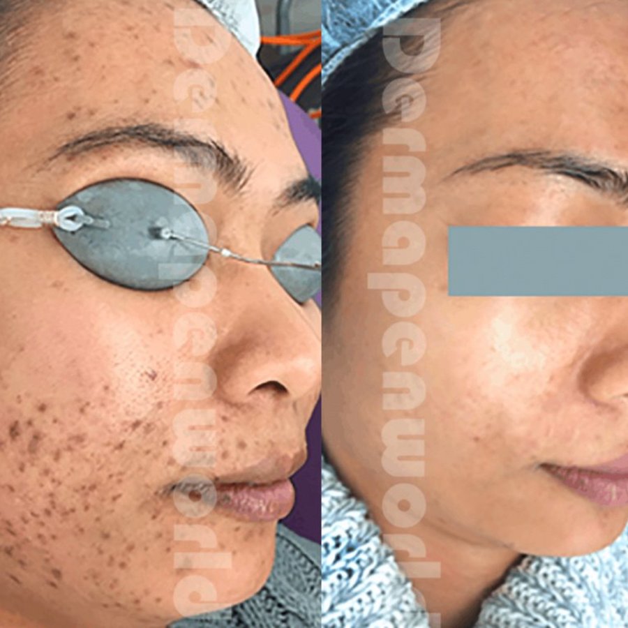 Skin Vitality Medical Clinic - London - Skin Vitality Medical Clinic - London