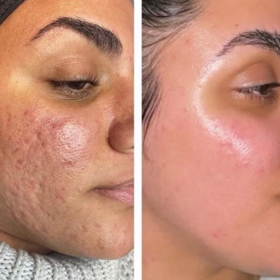 Skin Vitality Medical Clinic - London - Skin Vitality Medical Clinic - London