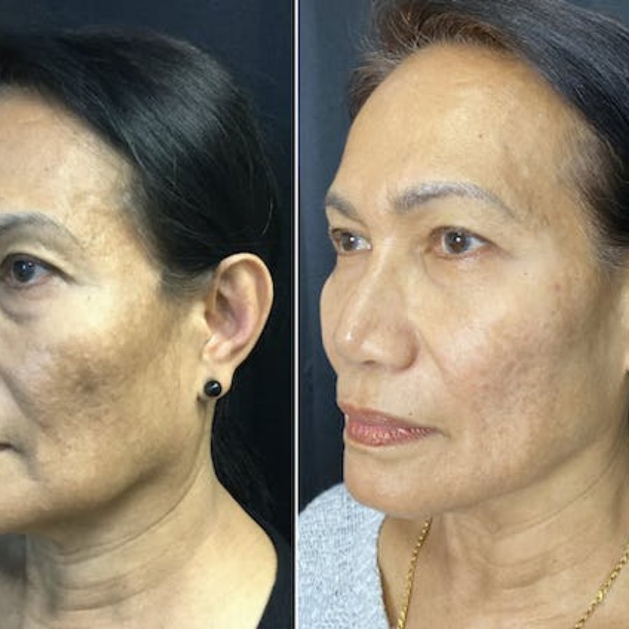 Skin Vitality Medical Clinic - London - Skin Vitality Medical Clinic - London