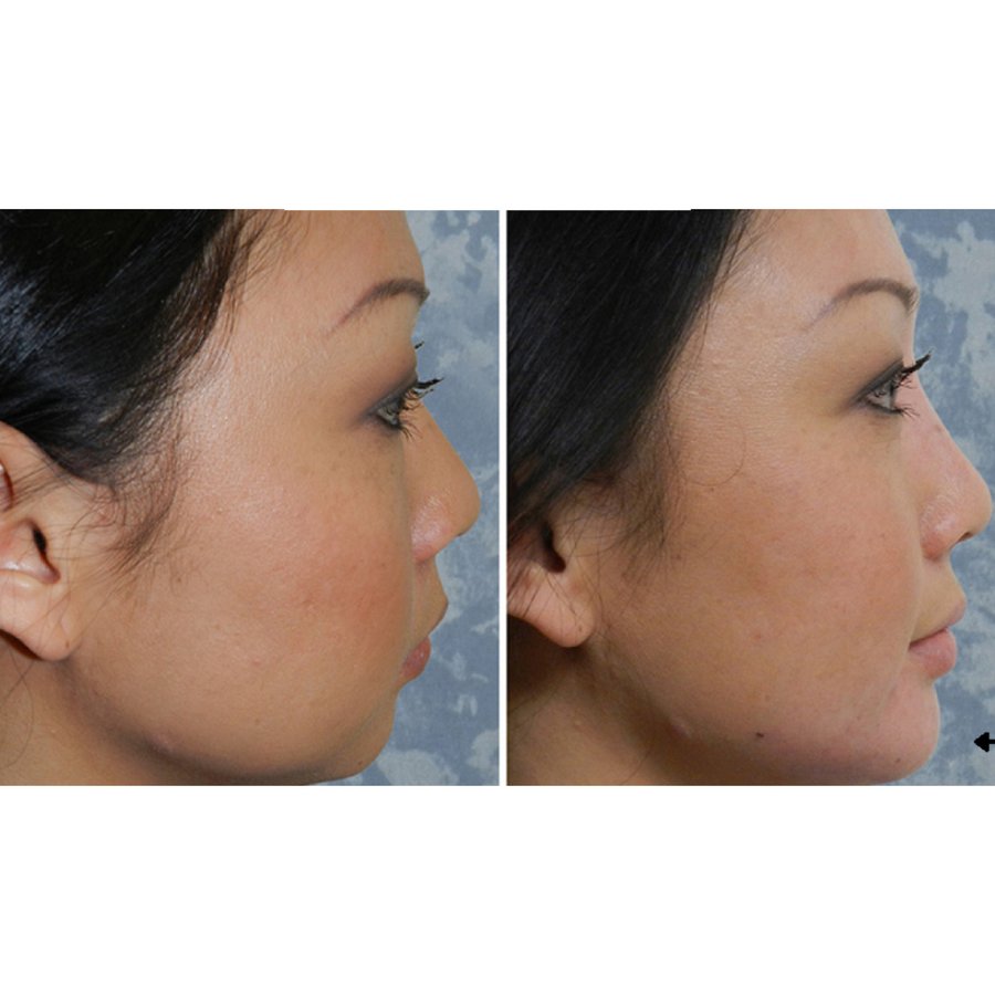 Skin Vitality Medical Clinic - Milton - Skin Vitality Medical Clinic - Milton