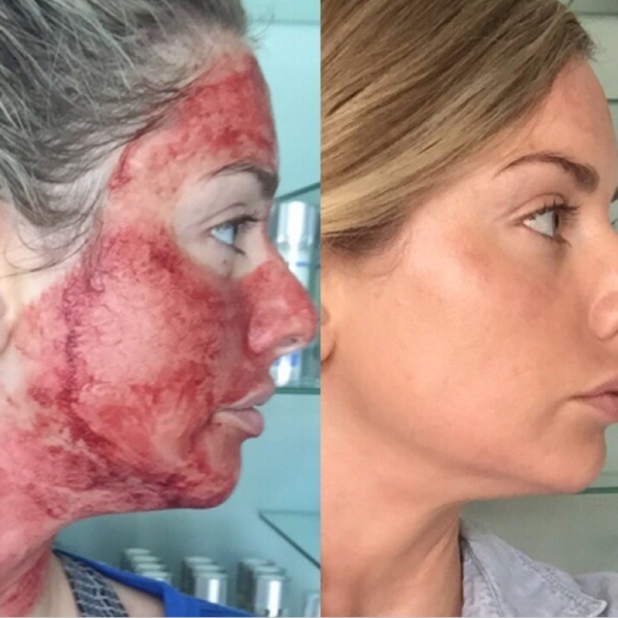 Skin Vitality Medical Clinic - Milton - Skin Vitality Medical Clinic - Milton