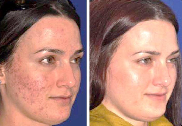 Skin Vitality Medical Clinic - Milton - Skin Vitality Medical Clinic - Milton