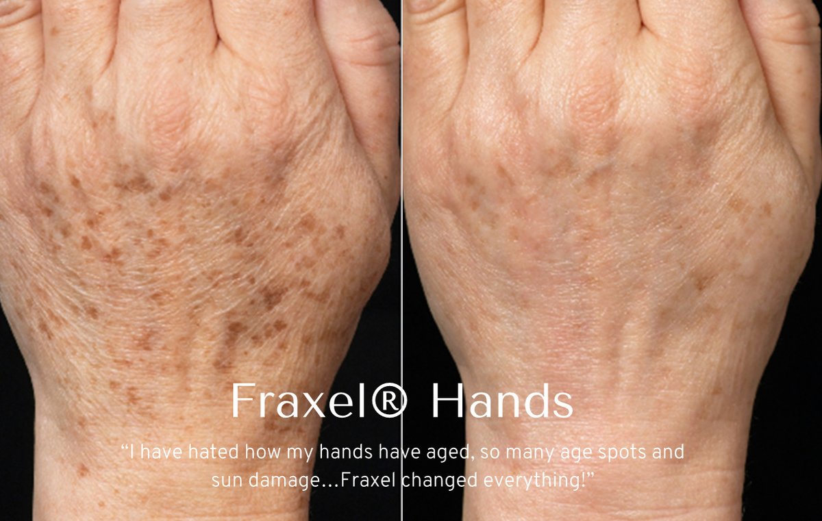 Skin Vitality Medical Clinic - Milton - Skin Vitality Medical Clinic - Milton