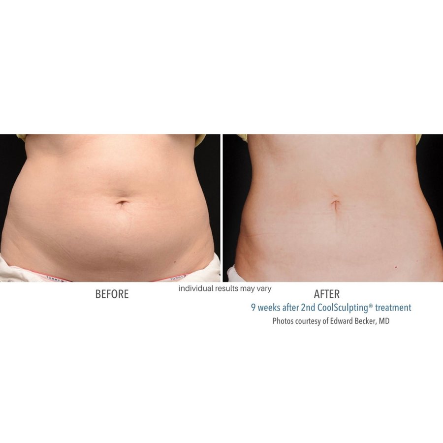 Skin Vitality Medical Clinic - Richmond Hill - Skin Vitality Medical Clinic - Richmond Hill