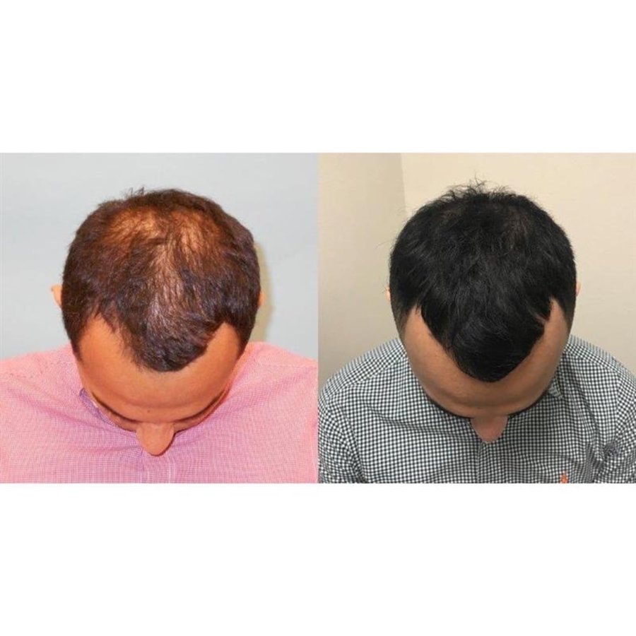 Skin Vitality Medical Clinic - Richmond Hill - Skin Vitality Medical Clinic - Richmond Hill