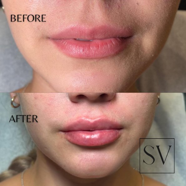 Skin Vitality Medical Clinic - Stoney Creek - Skin Vitality Medical Clinic - Stoney Creek