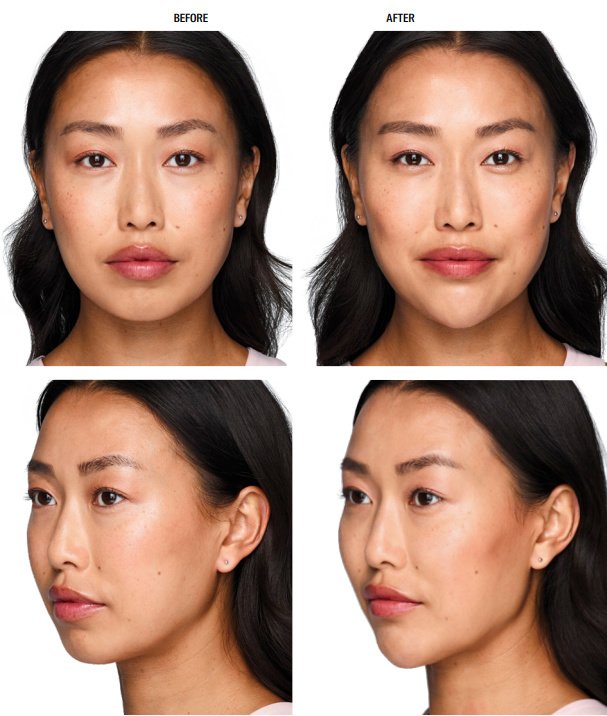 Skin Vitality Medical Clinic - Stoney Creek - Skin Vitality Medical Clinic - Stoney Creek