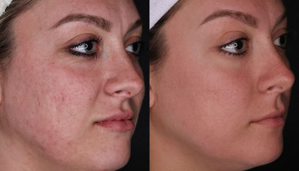 Skin Vitality Medical Clinic - Stoney Creek - Skin Vitality Medical Clinic - Stoney Creek