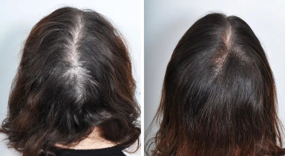 Skin Vitality Medical Clinic - Stoney Creek - Skin Vitality Medical Clinic - Stoney Creek