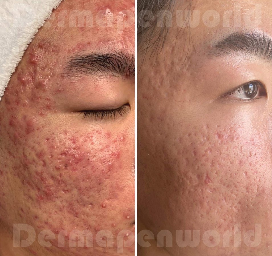 Skin Vitality Medical Clinic - Stoney Creek - Skin Vitality Medical Clinic - Stoney Creek