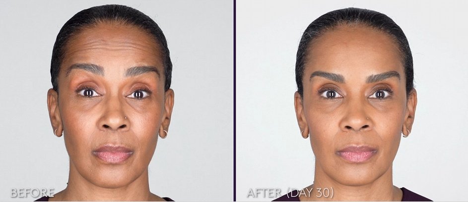 Skin Vitality Medical Clinic - Stoney Creek - Skin Vitality Medical Clinic - Stoney Creek