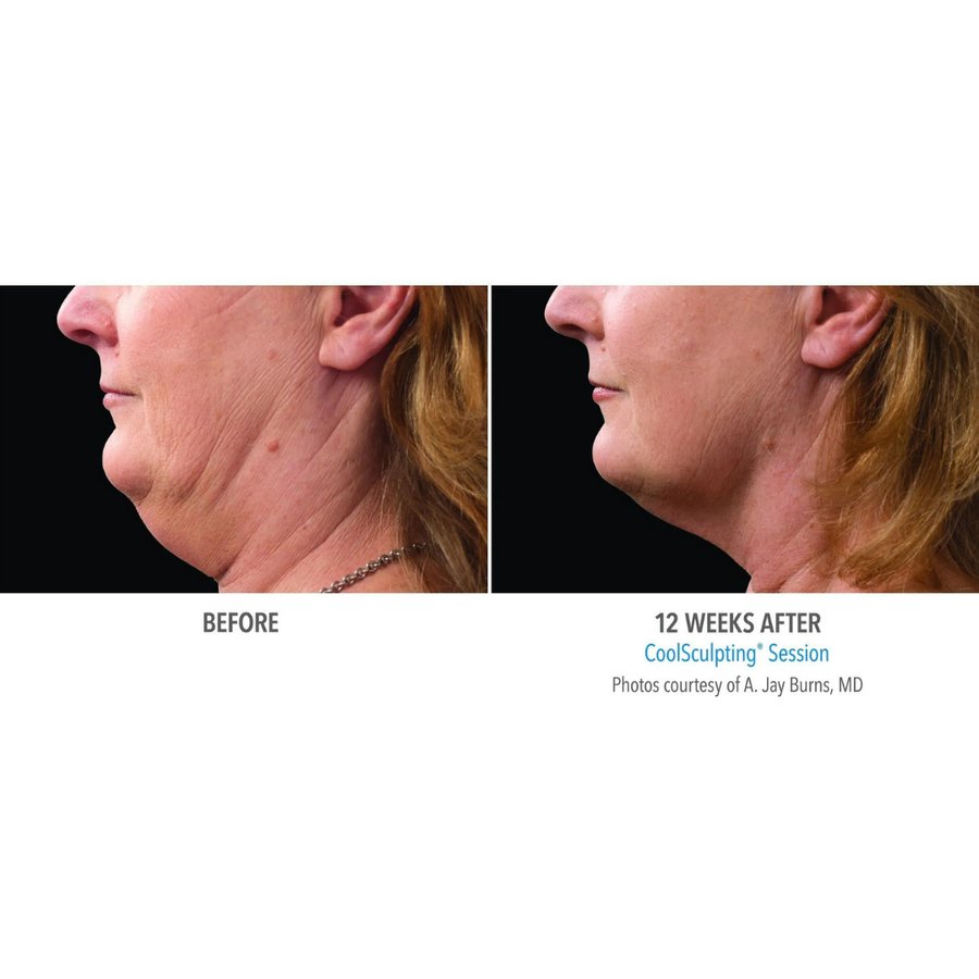 Skin Vitality Medical Clinic - Toronto - Skin Vitality Medical Clinic - Toronto