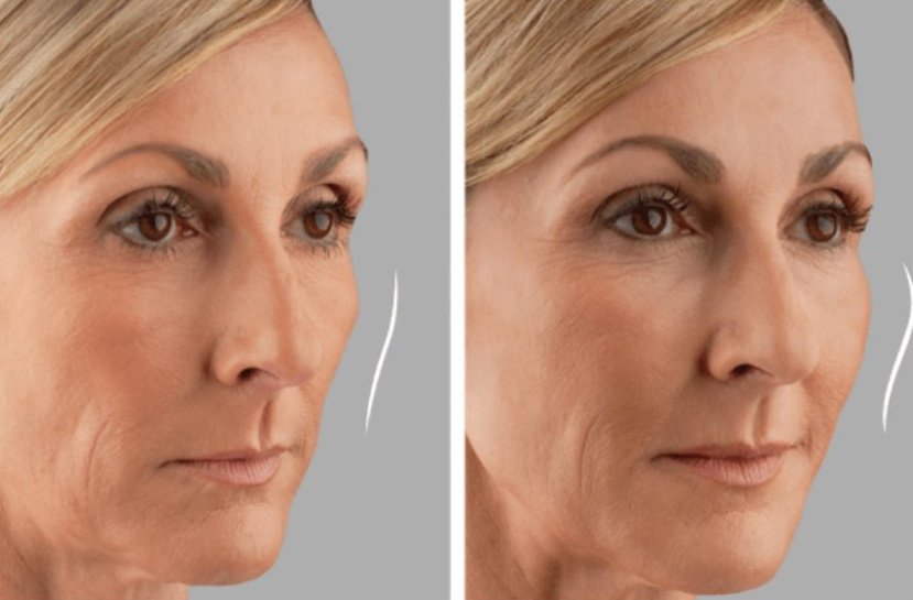 Skin Vitality Medical Clinic - Whitby - Skin Vitality Medical Clinic - Whitby