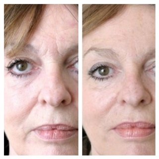 Skinboost - Skinboost