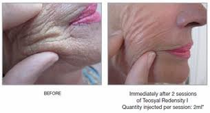 Skinboost - Skinboost