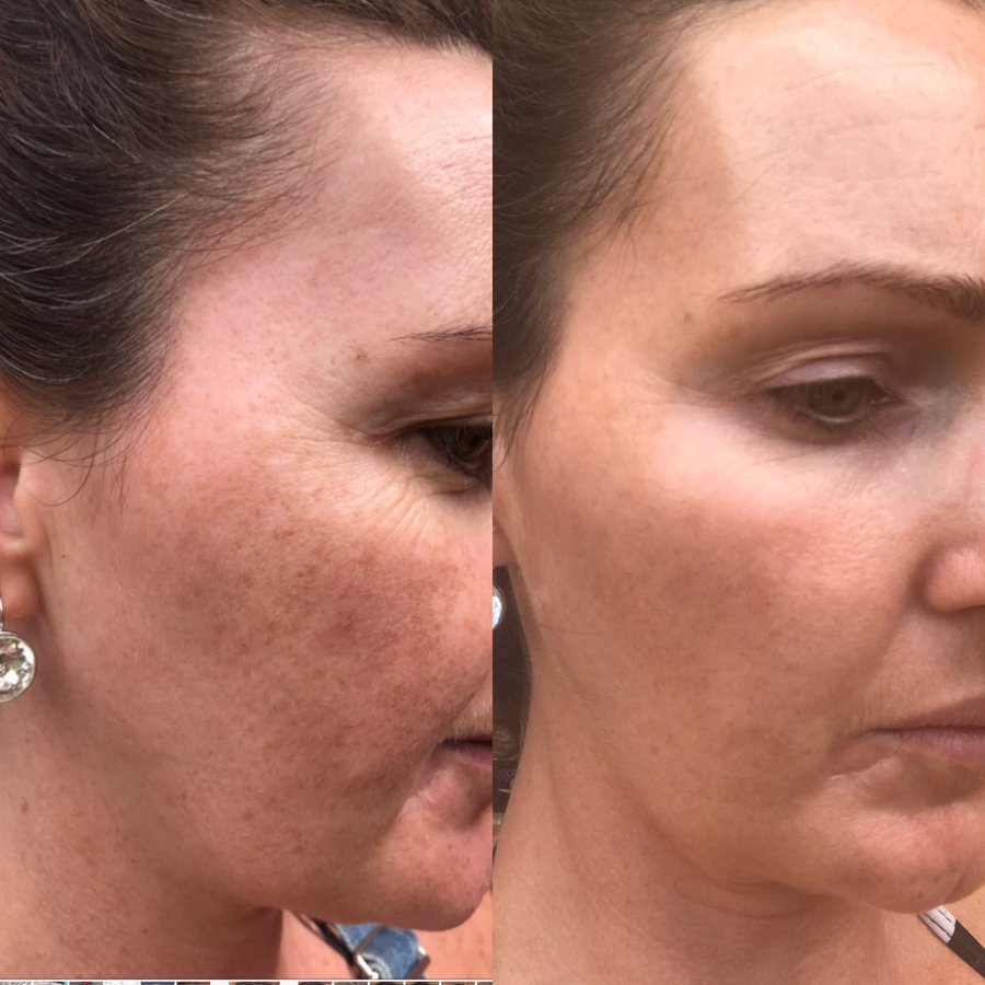 Skinfinity Medispa - Skinfinity Medispa