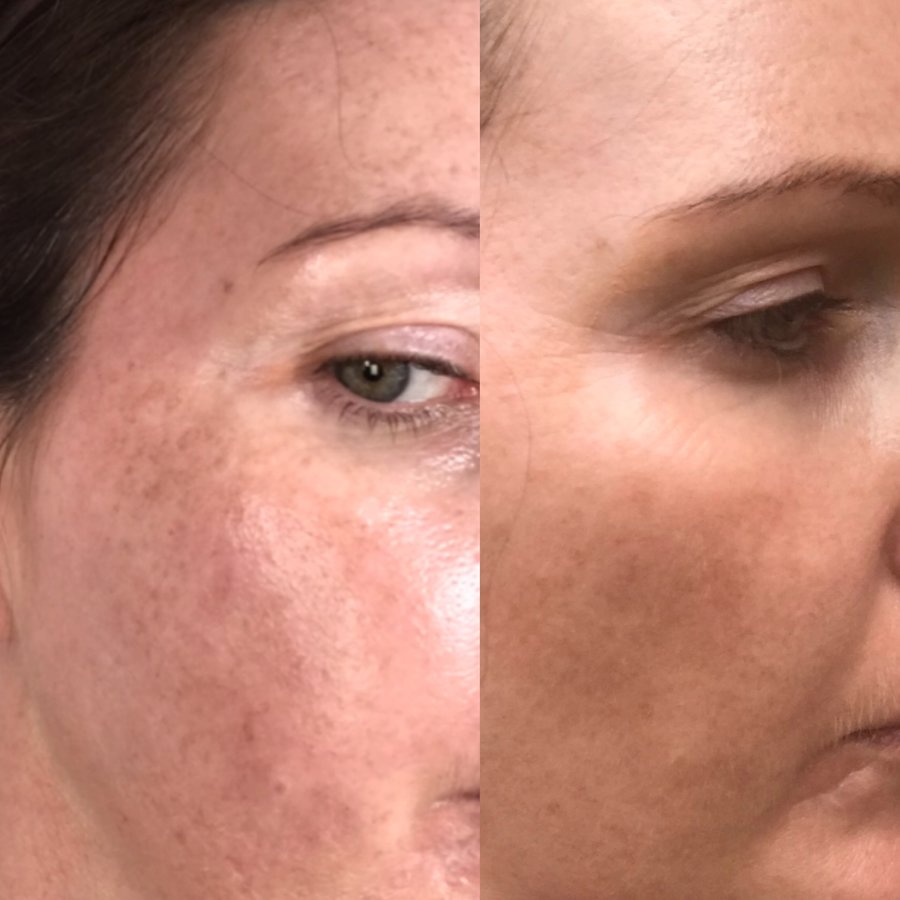 Skinfinity Medispa - Skinfinity Medispa