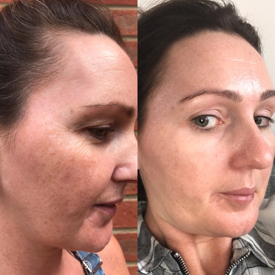 Skinfinity Medispa - Skinfinity Medispa