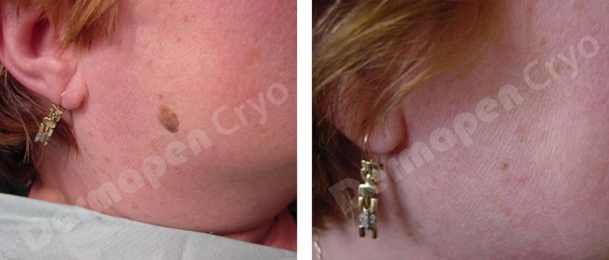 علوم الجلد1066 - Skin-Science1066