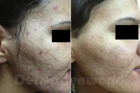 علوم الجلد1066 - Skin-Science1066