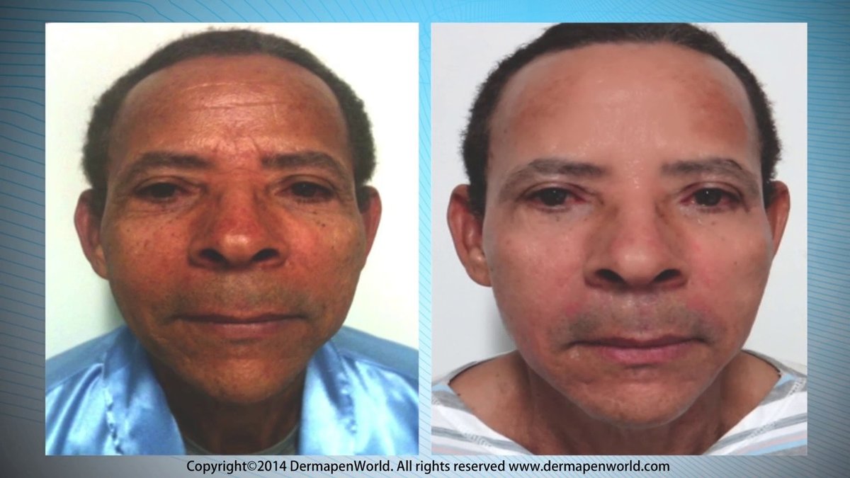 علوم الجلد1066 - Skin-Science1066