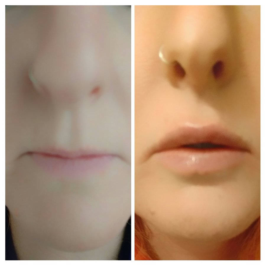 Skyn الطبيب - Skyn Doctor