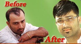 مركز ذكي لنسج الشعر وتثبيته - Smart hair weaving and hair fixing centre