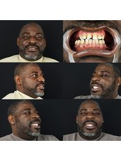 ابتسامة 4ever - Smile 4ever