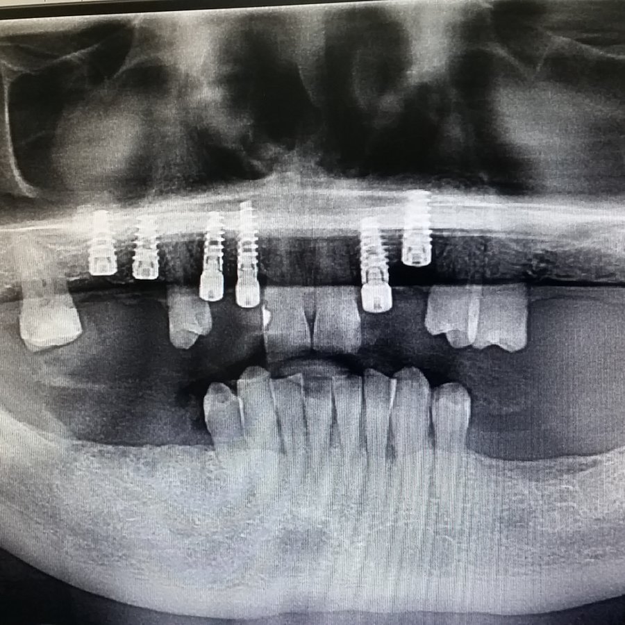 Smile Again Dental Clinic - Smile Again Dental Clinic