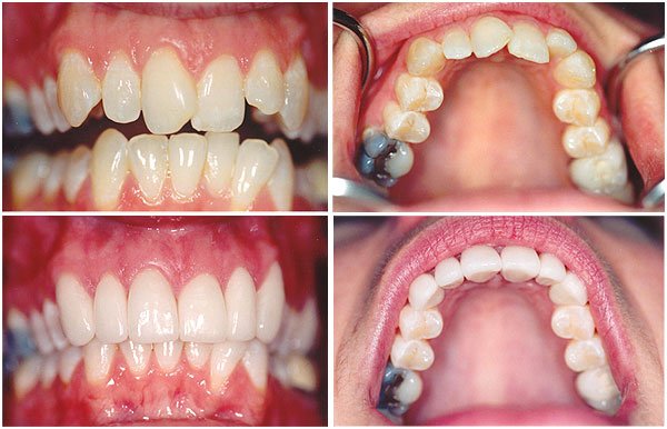 Smile Architect Invisible Braces Center - Smile Architect Invisible Braces Center