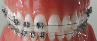 Smile Architect Invisible Braces Center - Smile Architect Invisible Braces Center