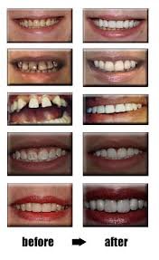 Smile Avenue Dental Clinic - Smile Avenue Dental Clinic
