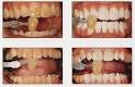 Smile Avenue Dental Clinic - Smile Avenue Dental Clinic