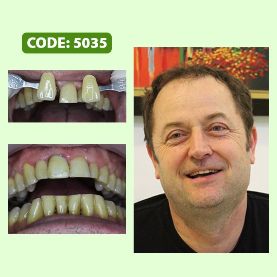 Smile Care Dental Clinic Hanoi Vietnam - Smile Care Dental Clinic Hanoi Vietnam