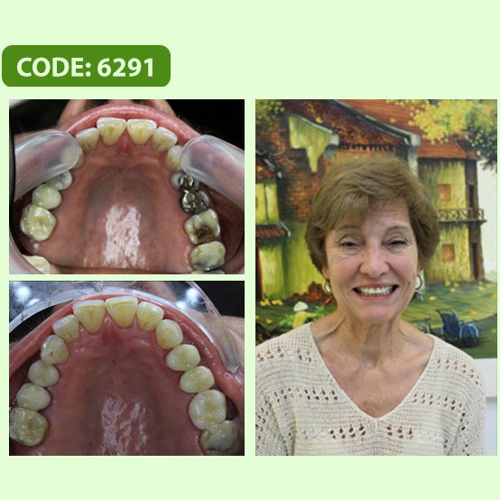 Smile Care Dental Clinic Hanoi Vietnam - Smile Care Dental Clinic Hanoi Vietnam