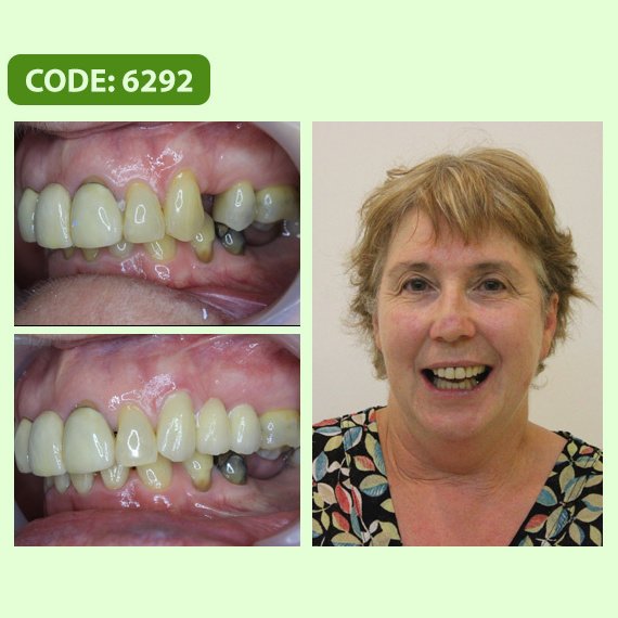 Smile Care Dental Clinic Hanoi Vietnam - Smile Care Dental Clinic Hanoi Vietnam