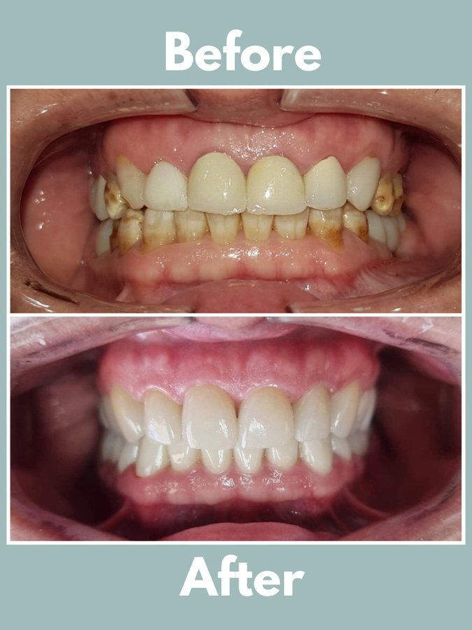 Smile Center - Smile Center