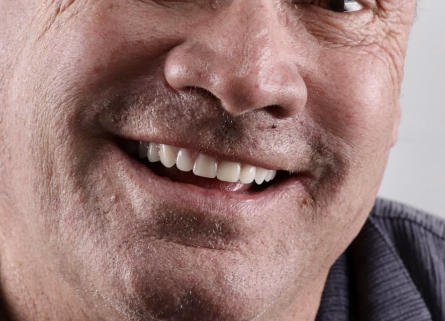 Smile Center - Smile Center