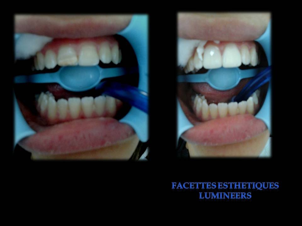مركز الابتسامة - SMILE CENTRE