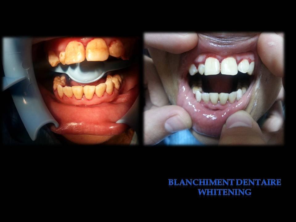 مركز الابتسامة - SMILE CENTRE