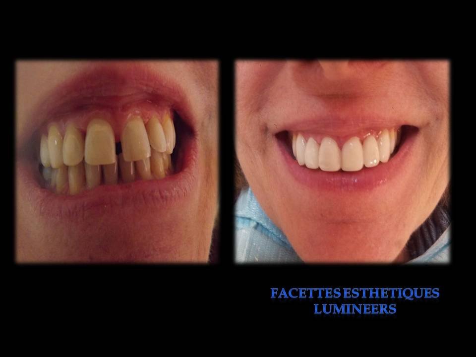 مركز الابتسامة - SMILE CENTRE